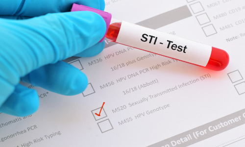 Shame-Free, Pleasure-Positive: Healing STI Stigma in Queer and Open Communities